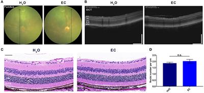 (–)-Epicatechin Provides Neuroprotection in Sodium Iodate-Induced Retinal Degeneration